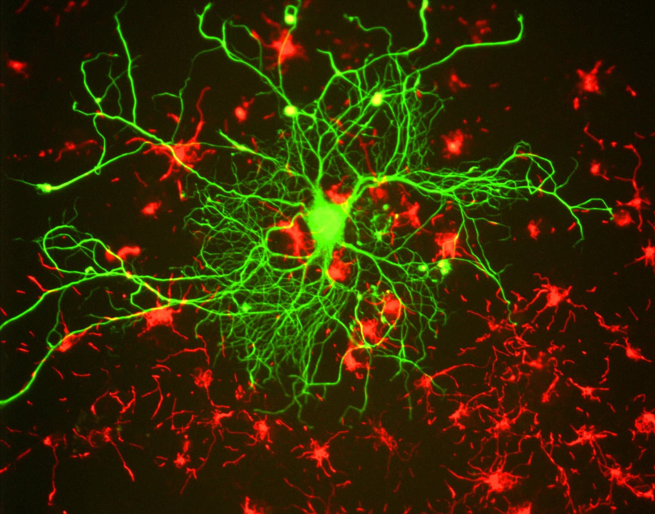 Fluorescent microscopy image of a neuron in tissue culture.